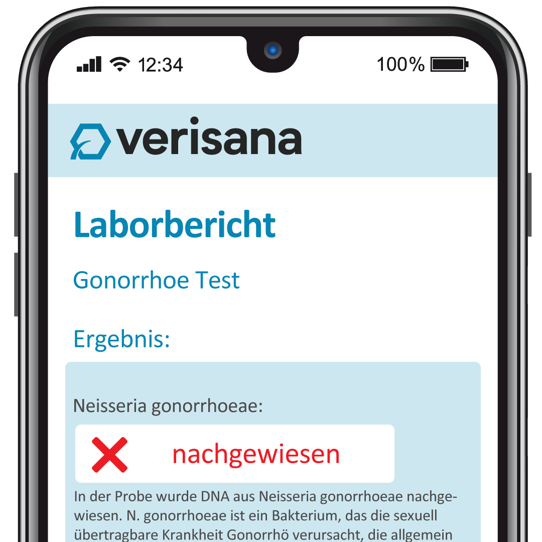 verisana-gonorrhoe-test-mann-urin-test-f-r-zu-hause image 3