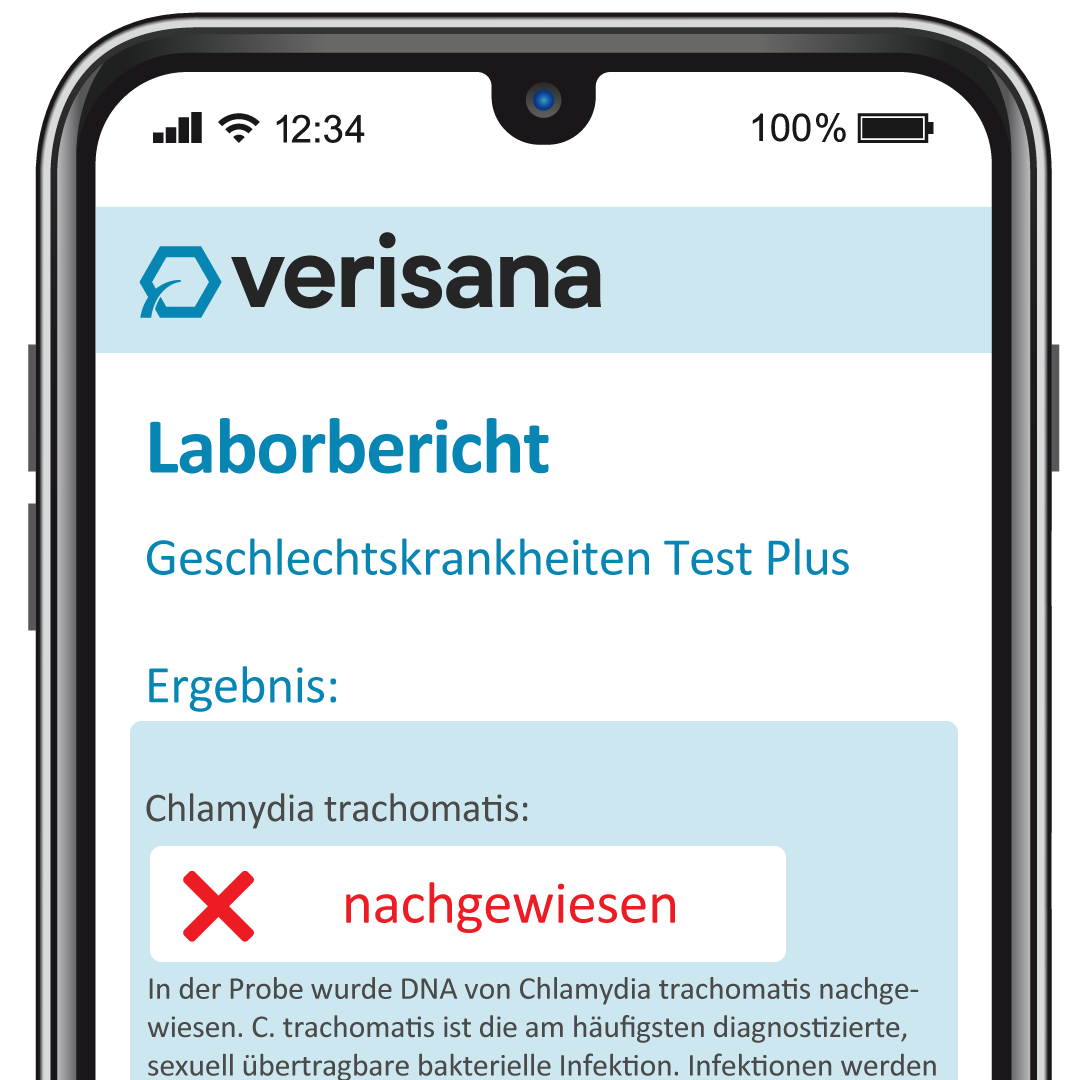 verisana-geschlechtskrankheiten-test-plus-f-r-m-nner-urin-selbsttest-auf-8-erreg image 2